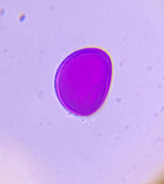 Single Snow drop pollen, Using an an oil immersion lens.