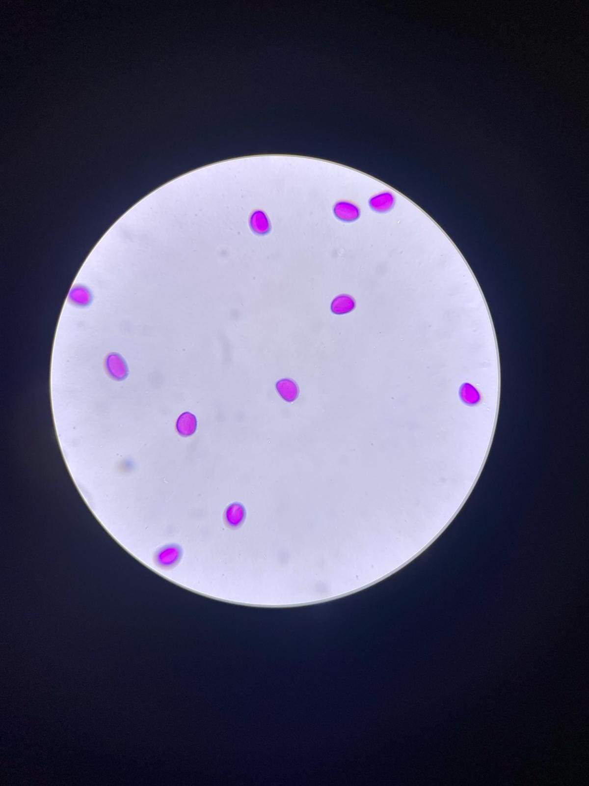 Snowdrop pollen under a microscope